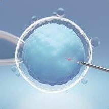 Self IVF-ICSI Treatment | ICSI Procedure - Banker IVF Hospital